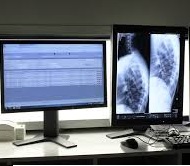 Remboursement  Mutuelle et  couverture des dépenses en radiologie