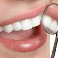 Comparateur de mutuelles : le meilleur moyen pour avoir une bonne mutuelle dentaire