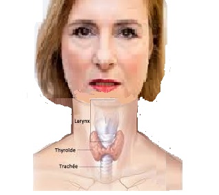 Santé des seniors : maladies endocriniennes des troubles des hormones thyroïdiennes