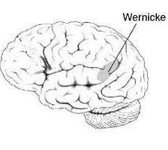 Santé des seniors : la démence de Wernicke