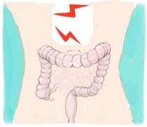 Mutuelle santé : les maladies chroniques de l’intestin